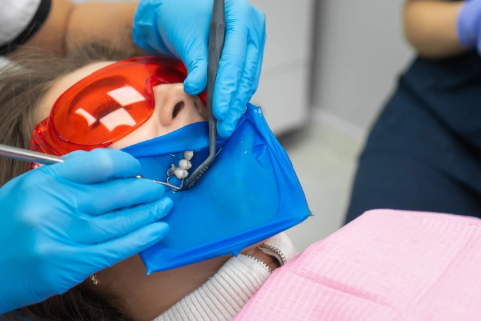 Teeth Whitening Treatment